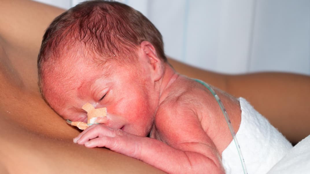 Frühchen auf der Brust seiner Mutter.