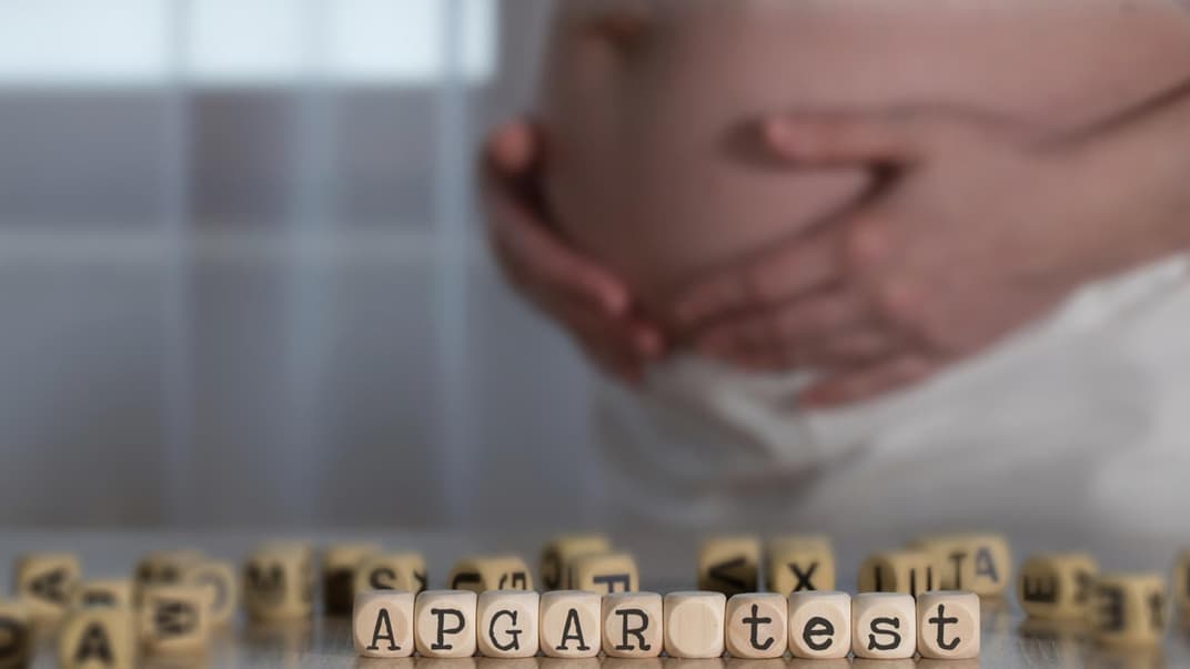 Schwangere Frau hinter dem Wort "Apgar-Test".