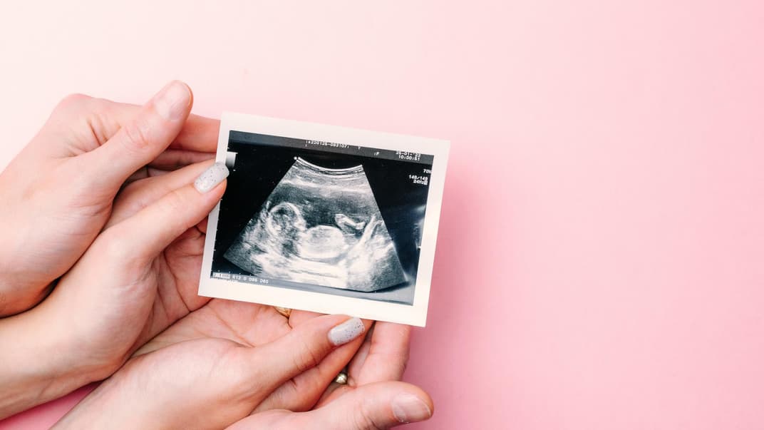 Frauenhände, die Ultraschallbild auf rosa Hintergrund halten.