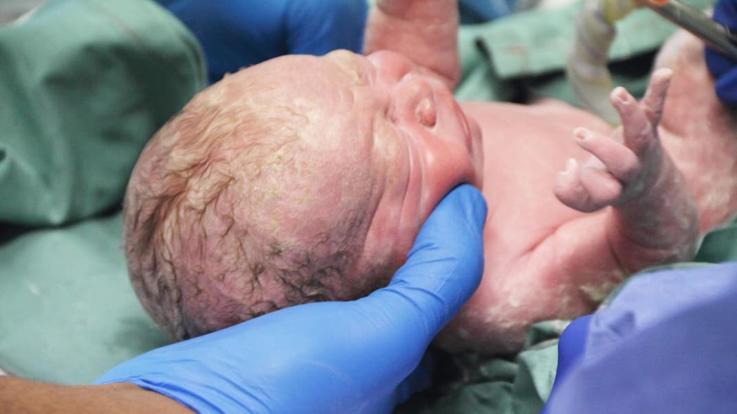 Neugeborenes kurz nach der Geburt.