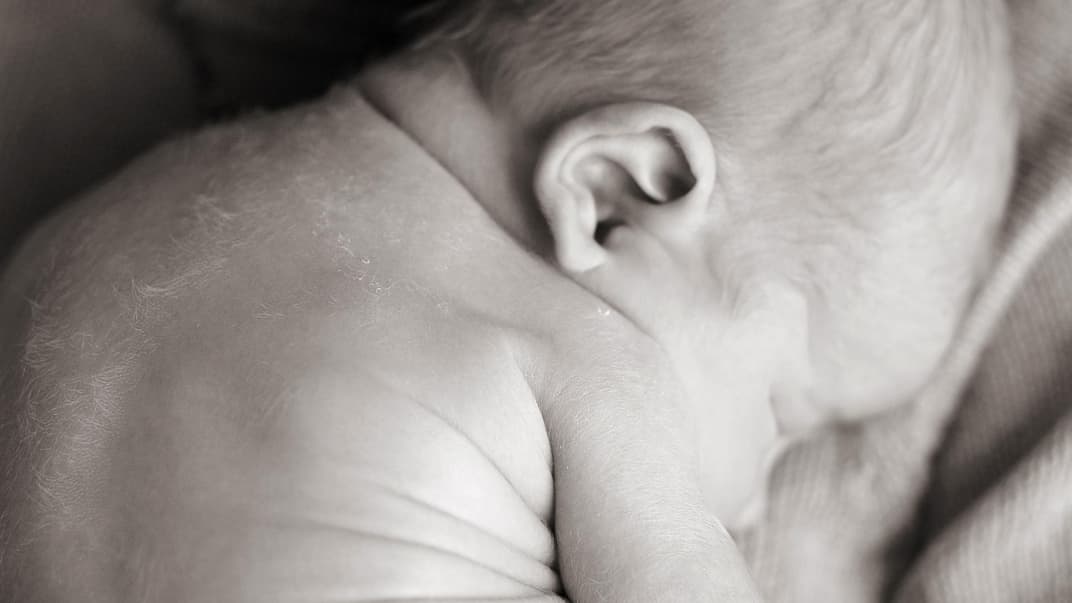 Lanugobehaarung tritt häufig auf der Stirn, den Ohren, im Gesicht oder dem Schulter- und Rückenbereich auf.