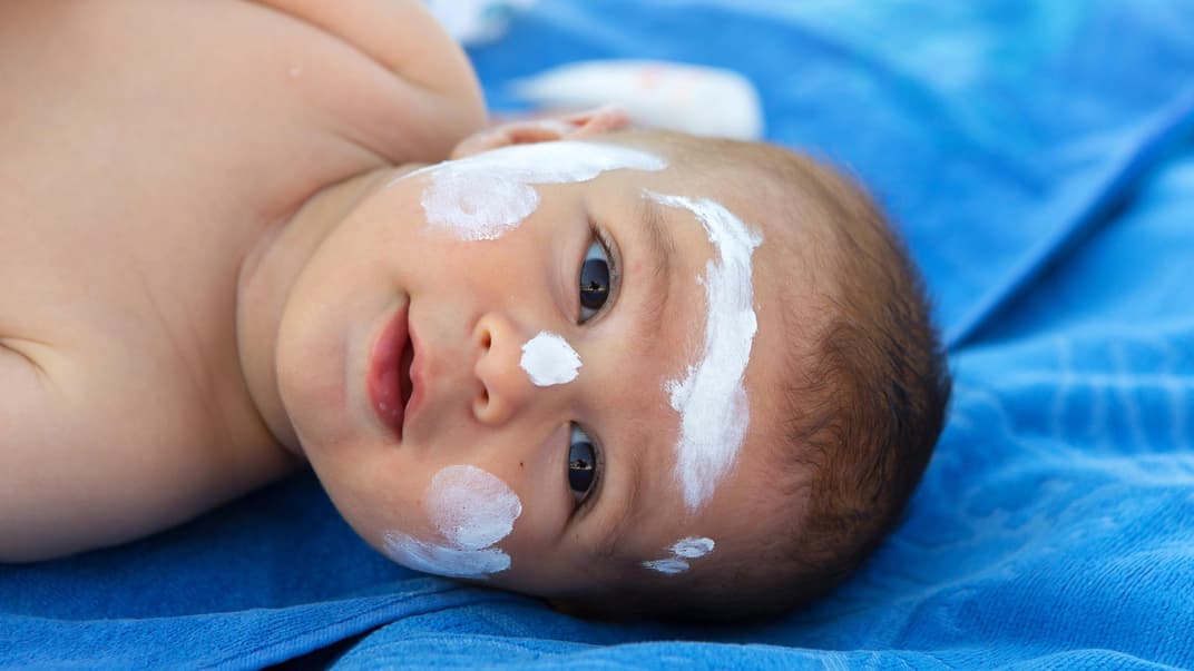 Babys und Kleinkinder sind besonders anfällig für Hitzepickel. Je heller der Hauttyp desto eher. 