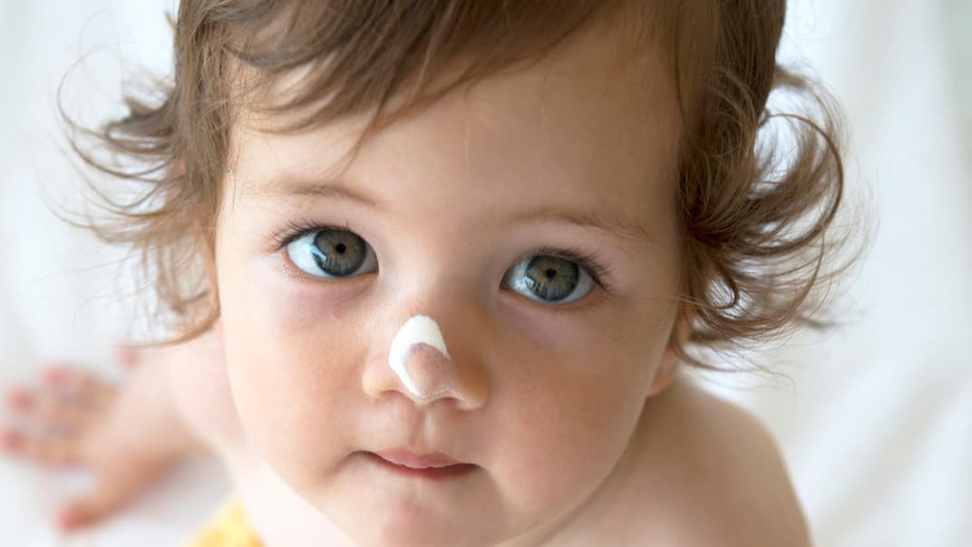 Kleinkind mit Cremetupfer auf der Nase.