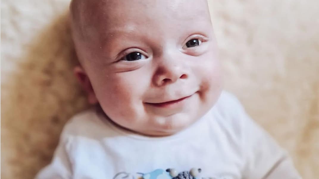 Ein kleines Baby mit Glasauge.