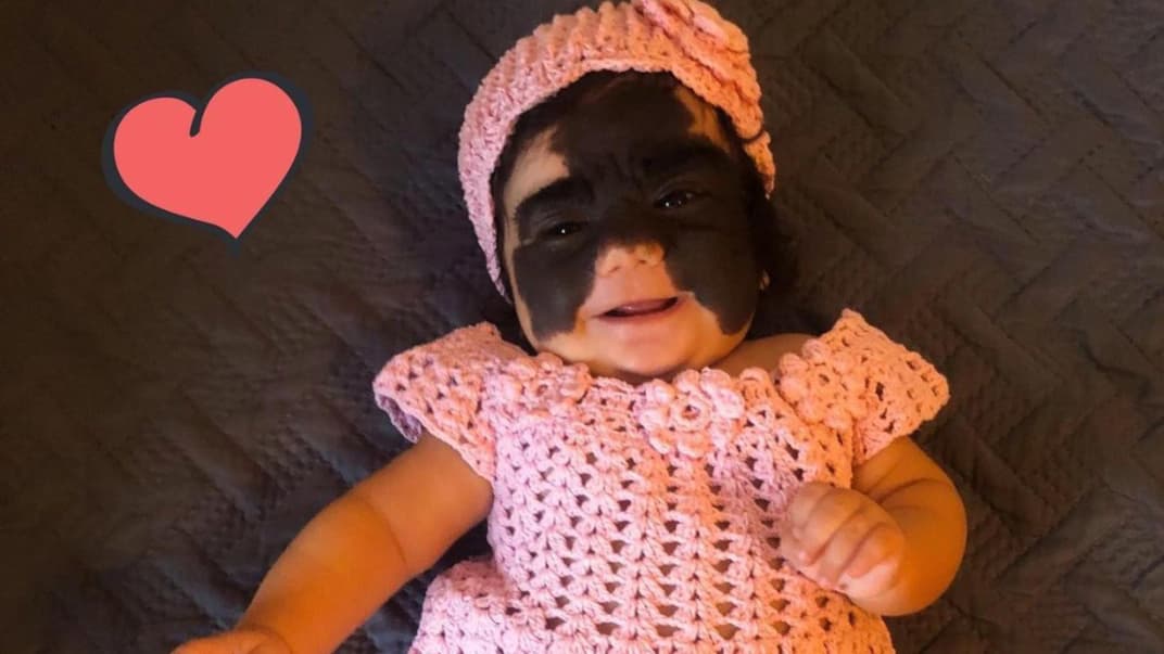 Mit diesem Bild wurde Luna Fenner, die aussieht, als würde sie eine Batman-Maske tragen, weltberühmt. 