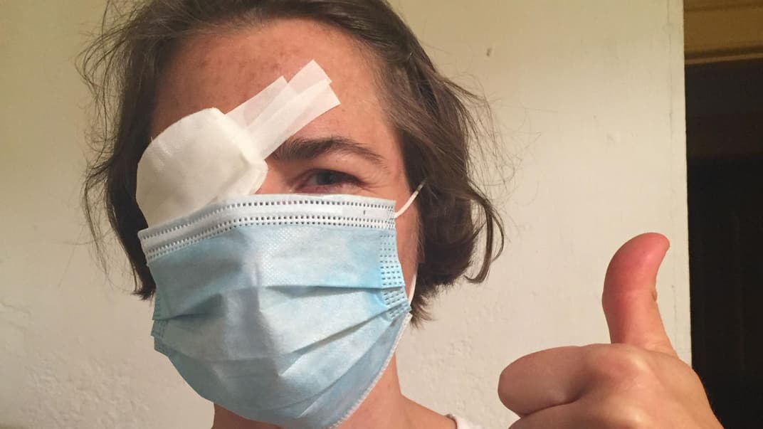 Ein kleiner Unfall ist im Alltag schnell passiert. Hier landete der Kinderfinger im Auge der Mutter.