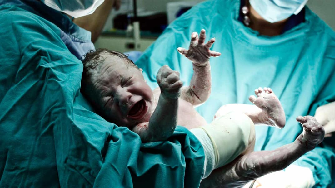 Ein Notkaiserschnitt ist für die Betroffenen nicht selten eine traumatische Erfahrung. 