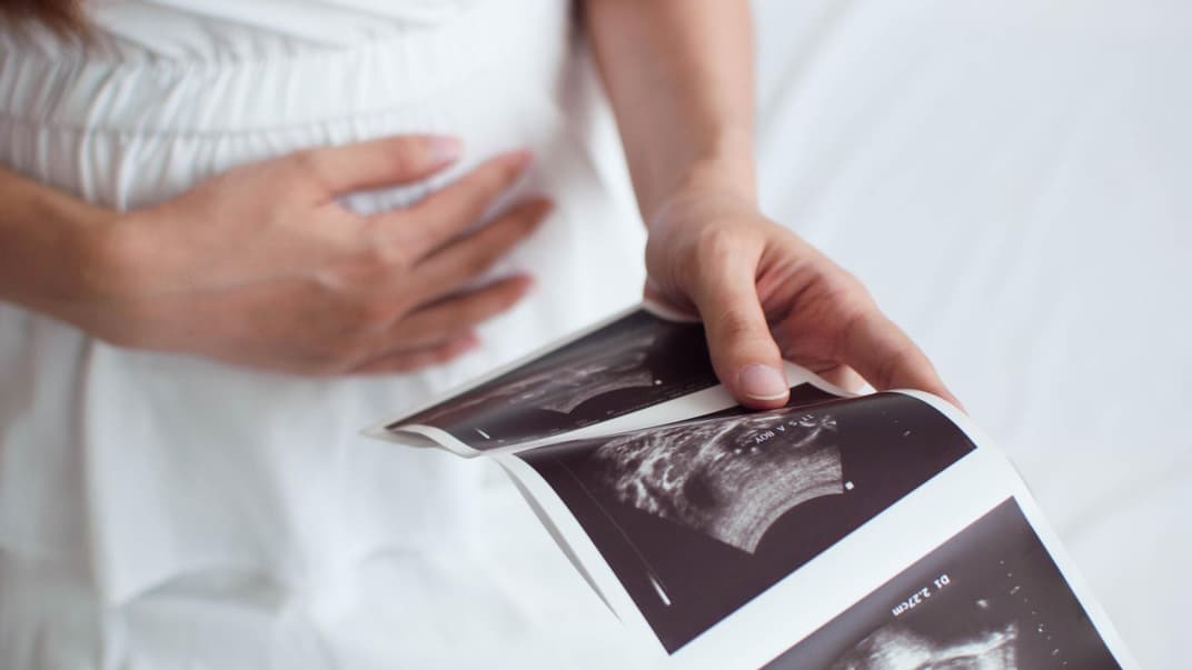 Schwangere Frau mit Ultraschallbildern.