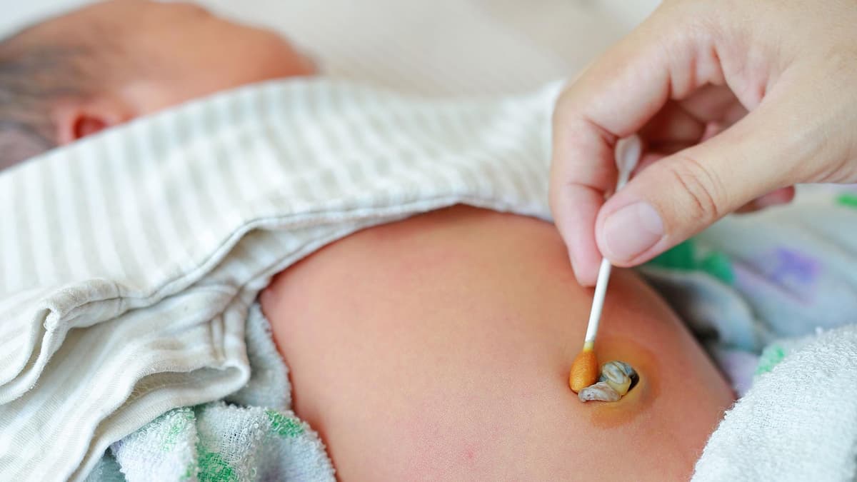 Wie Sieht Der Bauchnabel Aus Wenn Die Nabelschnur Abgefallen Ist www.leben-und-erziehen.de