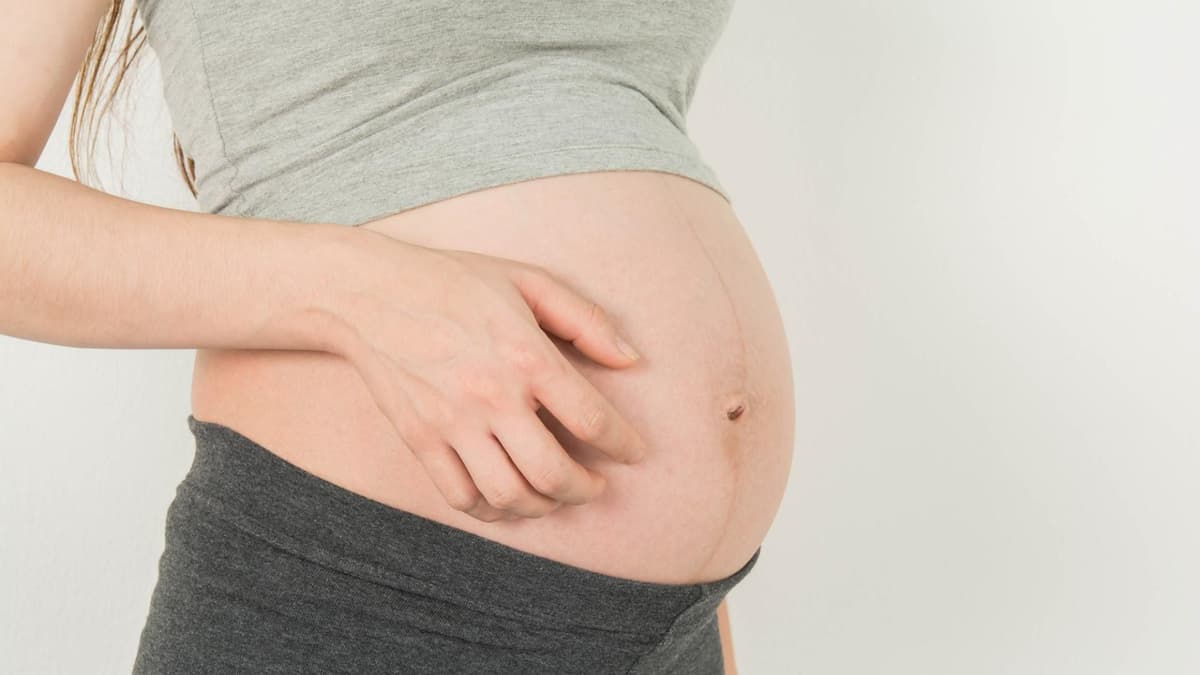 Juckreiz Am Ganzen Körper Schwangerschaft