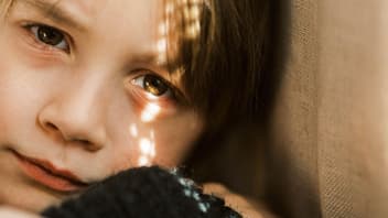 Eine Junge mit roten Augenringen