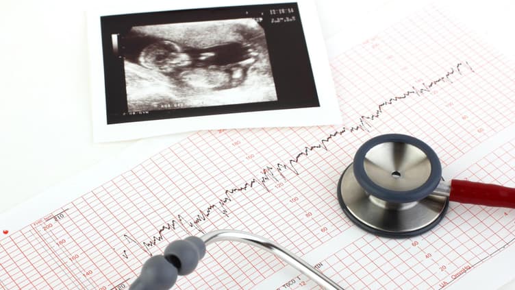 Mütter haben nach der Geburt die Möglichkeit, beim Krankenhaus einen detaillierten Geburtsbericht anzufordern. 