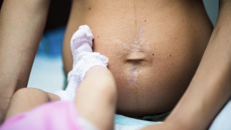 Aus bestimmten Gründen ist es gar nicht möglich, dass der Bauch nach der Geburt gleich wieder flach ist.