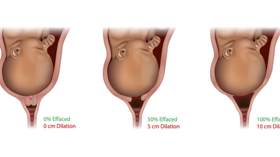 Muttermund 1cm Offen Wie Lange Noch Bis Zur Geburt Schon gewusst? So weit muss der Muttermund für die Geburt geöffnet sein