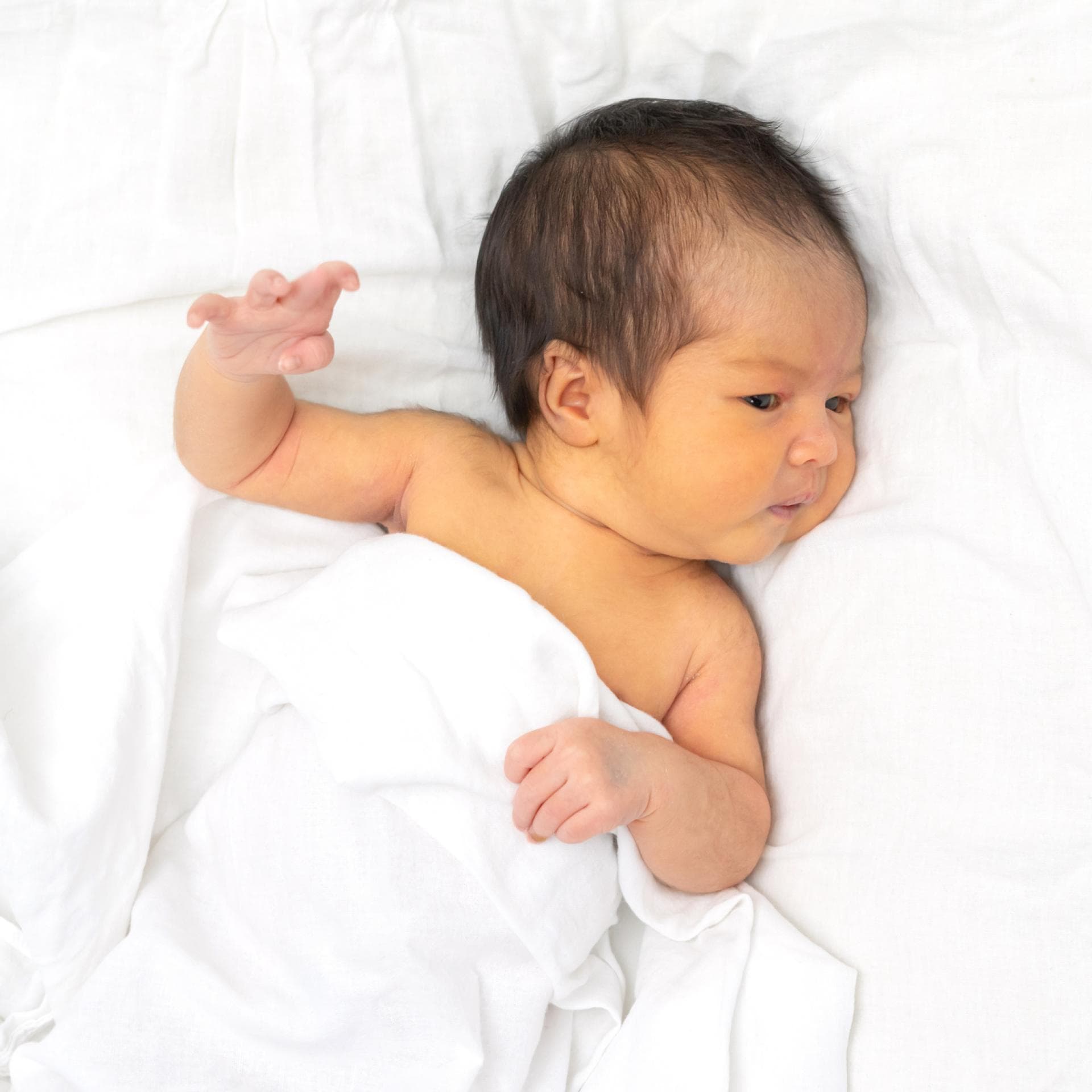 Baby mit Gelbsucht.