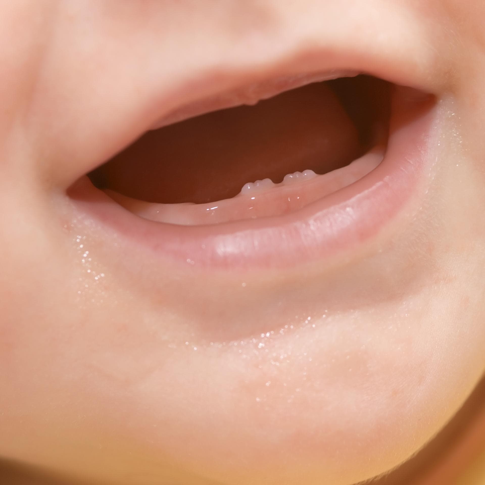 Hexenzähne: Wenn Babys mit Milchzähnen zur Welt kommen
