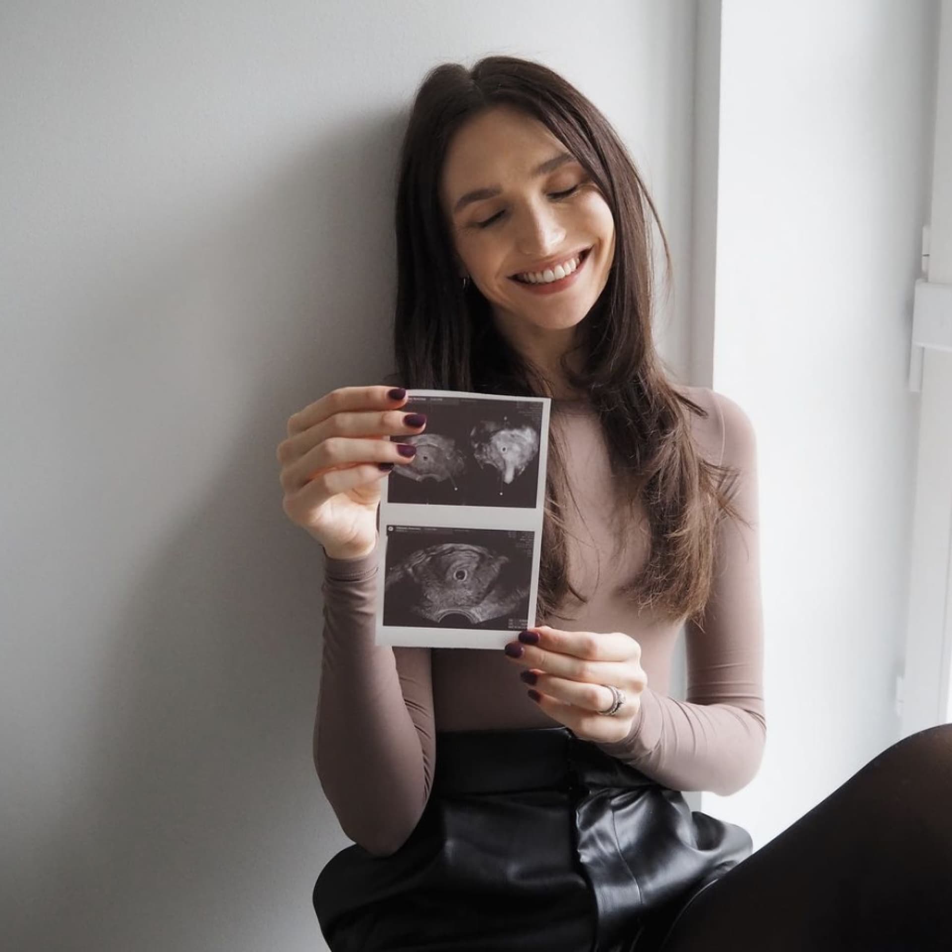 Anna Wilken ist schwanger