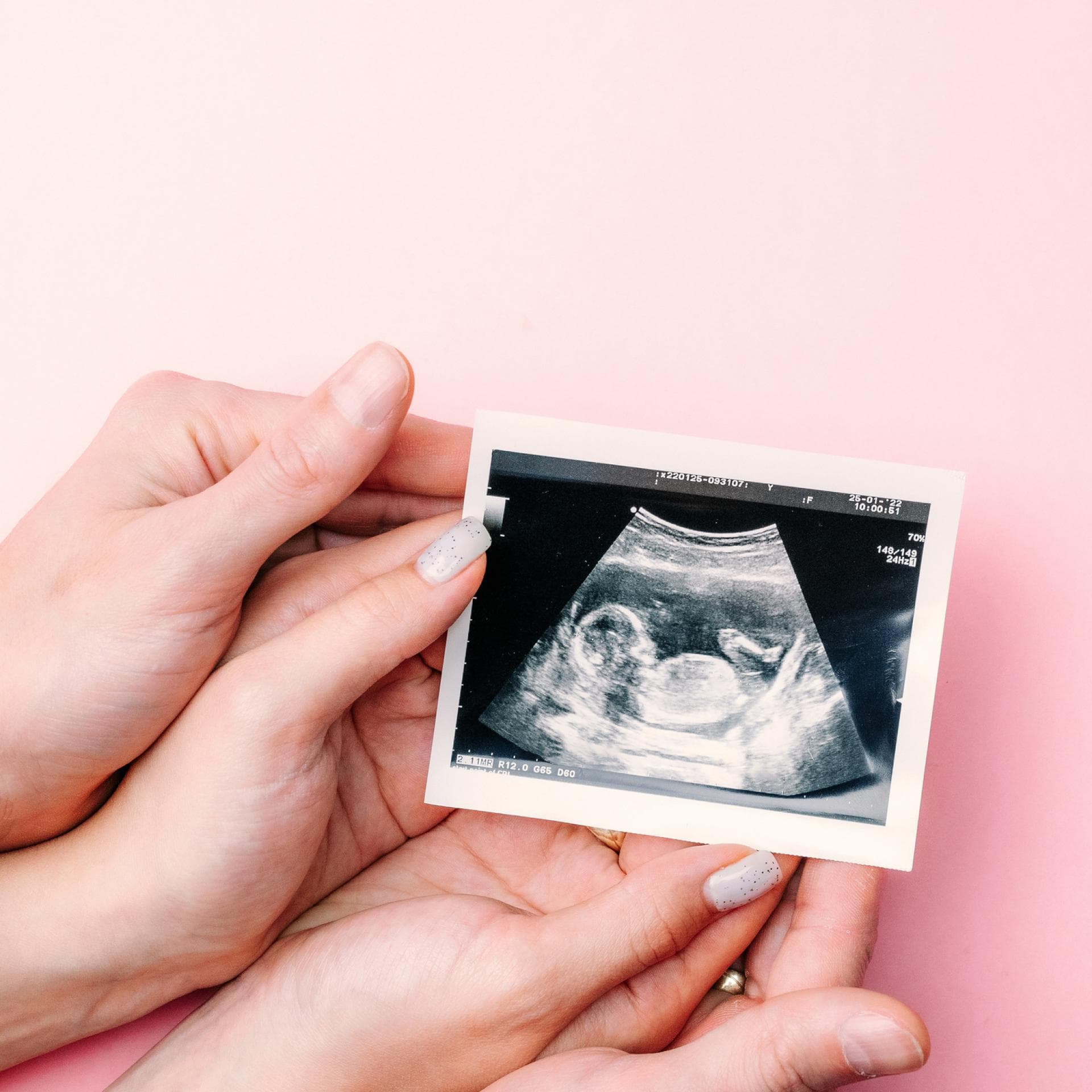 Frauenhände, die Ultraschallbild auf rosa Hintergrund halten.