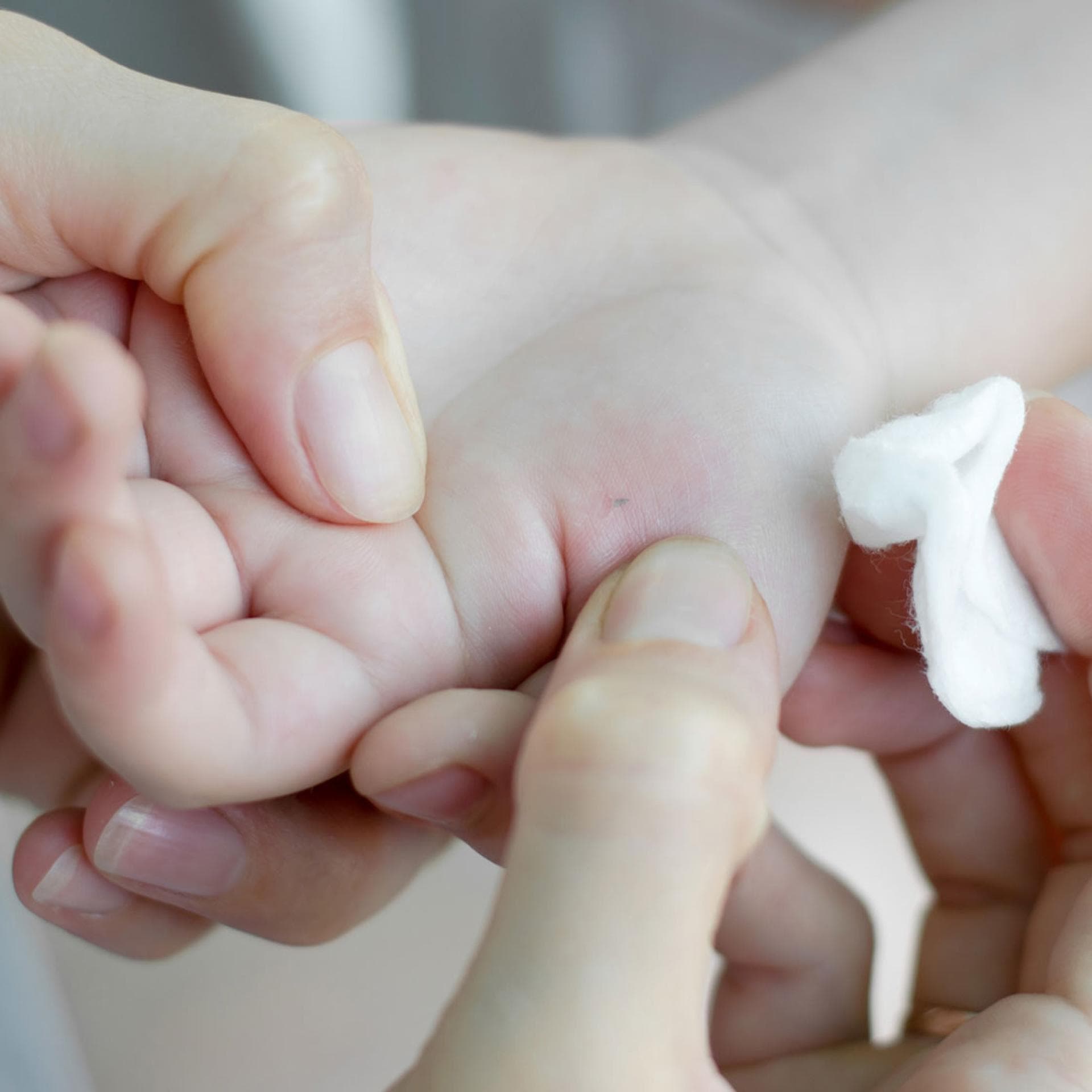 Kinderhand mit Splitter.