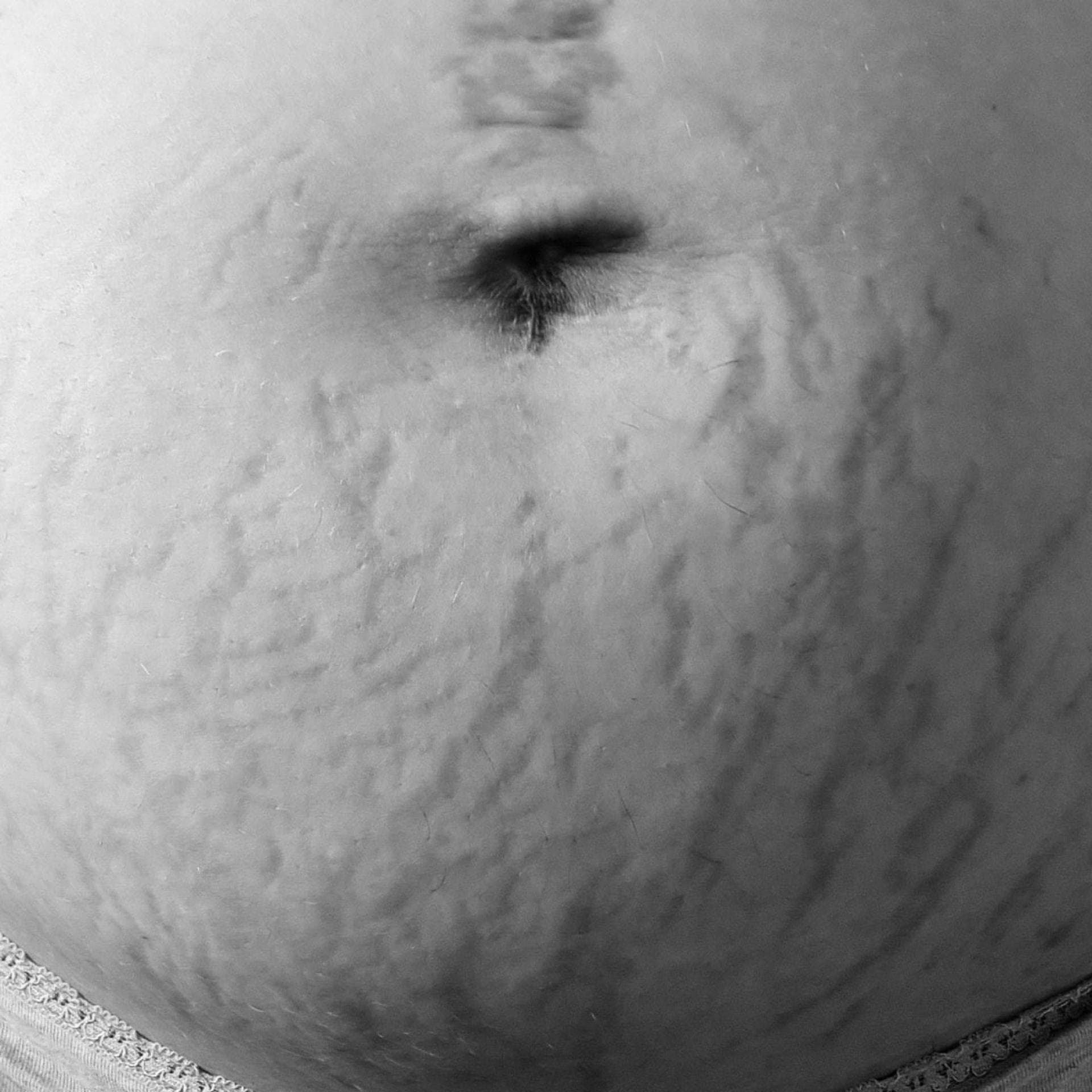 Bauch nach der Geburt