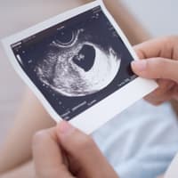 Frau betrachtet Ultraschallbild.