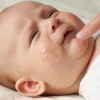 Baby bekommt das Gesicht eingecremt.