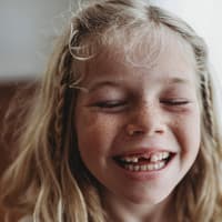 Die erste Zahnlücke ist für Kinder super aufregend ... natürlich auch, weil die Zahnfee dann vorbeischaut.