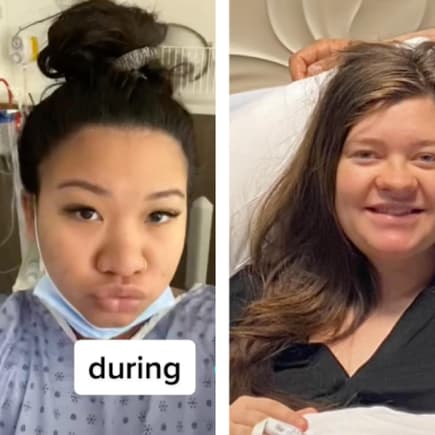 Zwei Frauen zeigen auf TikTok ihre Schwangerschaftsnase.