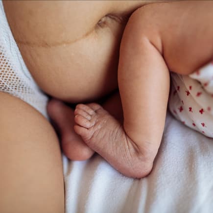 Bauch einer Mutter nach der Geburt mit Baby 