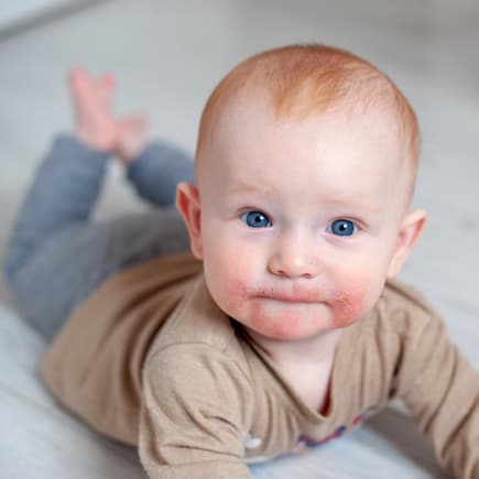Baby hat Ausschlag vom Zahnen