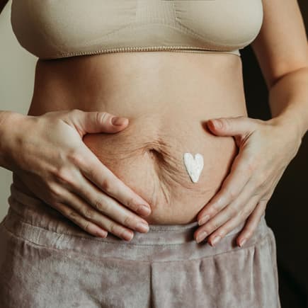 Frau mit faltigem Bauch nach der Geburt.