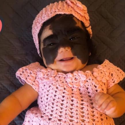 Mit diesem Bild wurde Luna Fenner, die aussieht, als würde sie eine Batman-Maske tragen, weltberühmt. 
