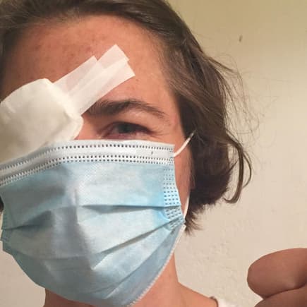 Ein kleiner Unfall ist im Alltag schnell passiert. Hier landete der Kinderfinger im Auge der Mutter.