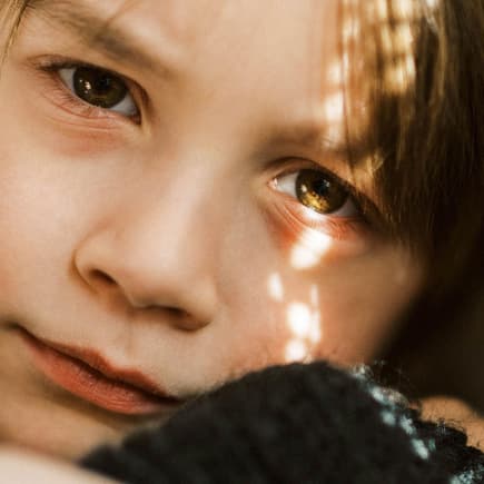 Eine Junge mit roten Augenringen
