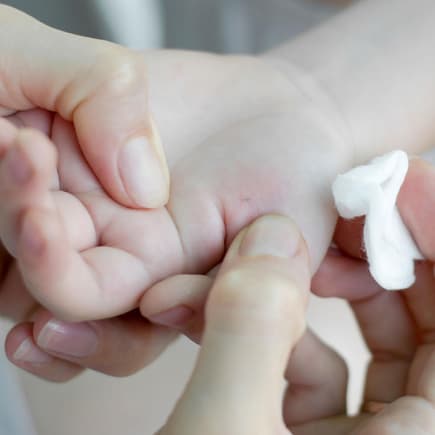 Kinderhand mit Splitter.