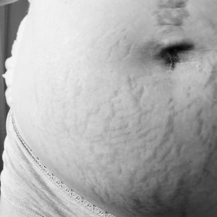 Der Bauch jeder Mama erzählt seine ganz eigene Geschichte.