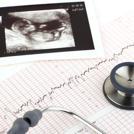 Mütter haben nach der Geburt die Möglichkeit, beim Krankenhaus einen detaillierten Geburtsbericht anzufordern. 