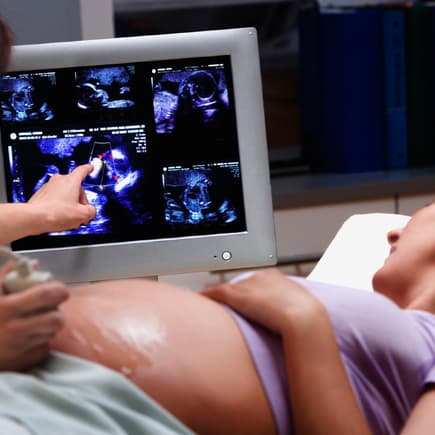 Medizinisch unbegründete Ultraschall-Untersuchungen sind ab 2021 verboten. 