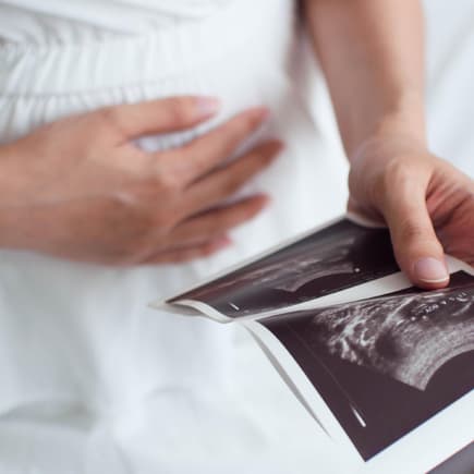 Schwangere Frau mit Ultraschallbildern.