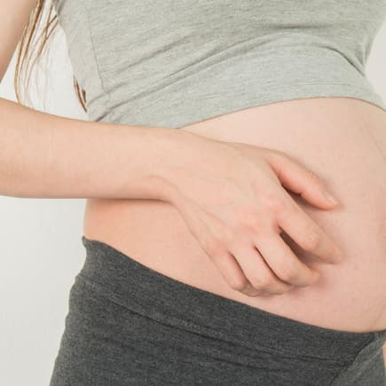 Juckreiz während der Schwangerschaft kann verschiedene Ursachen haben.