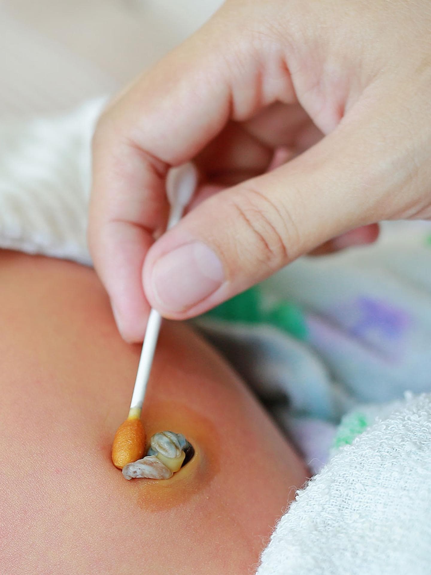 Babys Nabelschnur: Alle Infos zum Durchtrennen, Aufbewahren und Co.