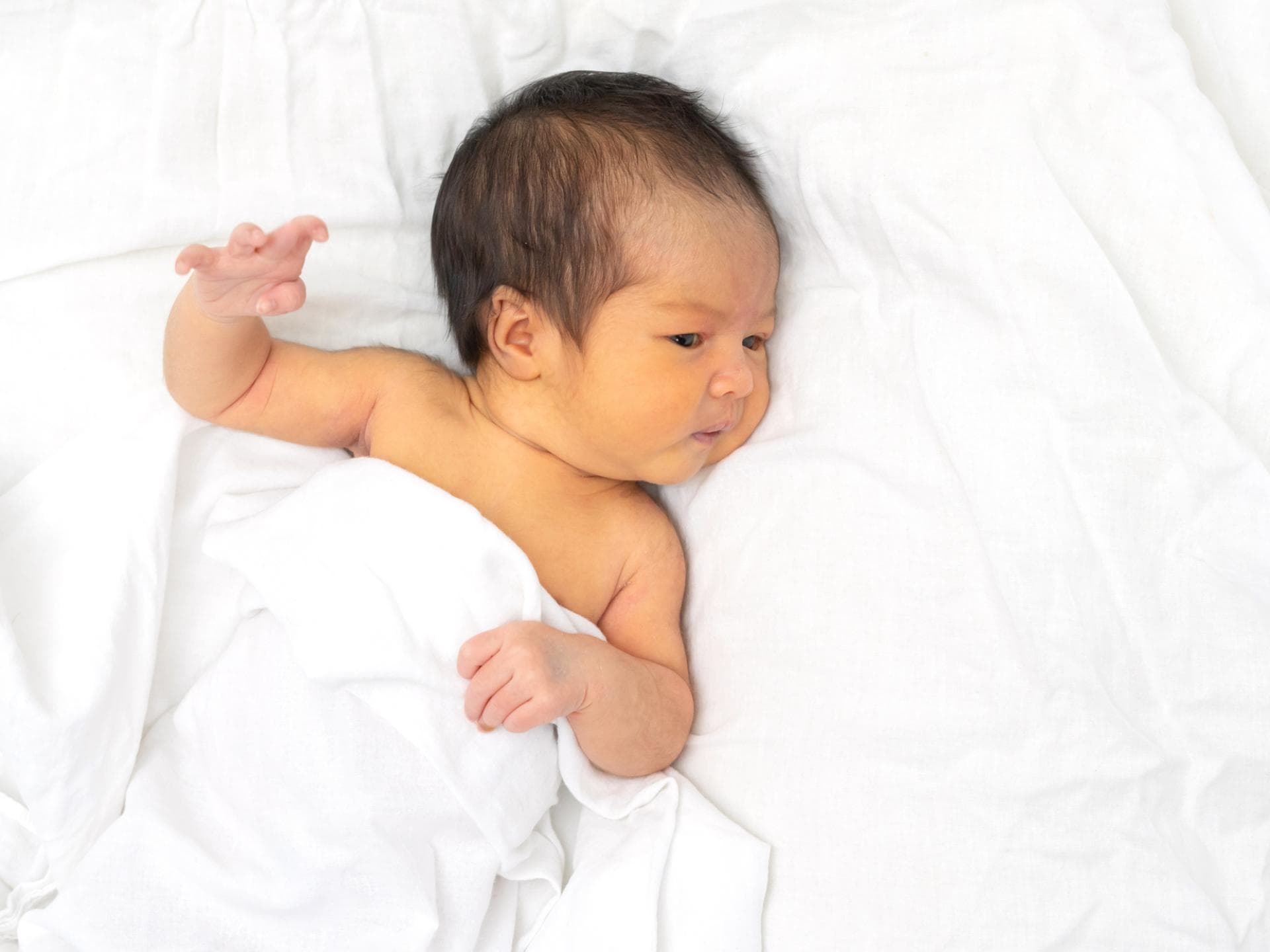 Baby mit Gelbsucht.