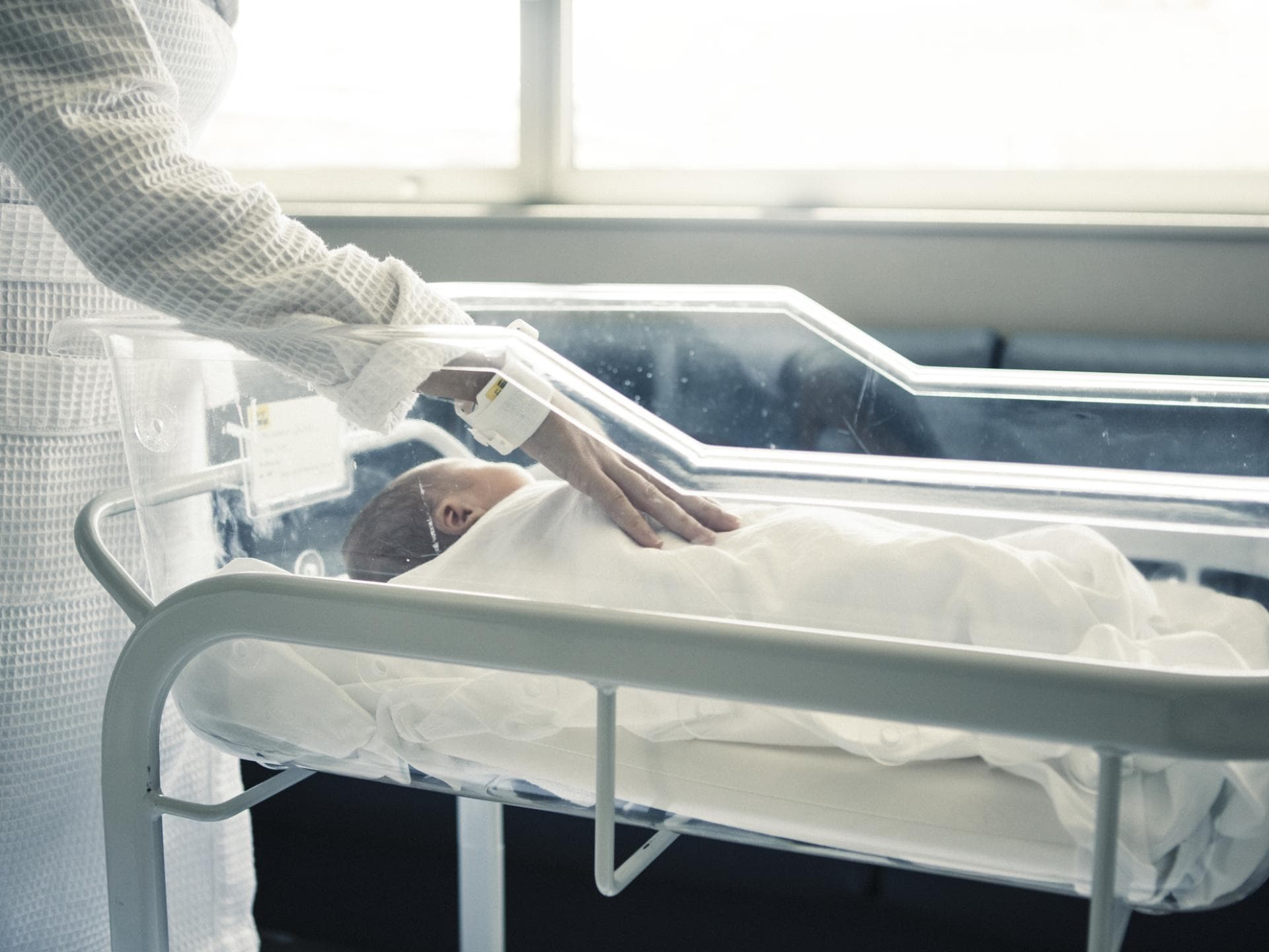 Baby direkt nach der Geburt verlassen wegen Treacher-Collins-Syndrom Baby direkt nach der Geburt verlassen wegen Treacher-Collins-Syndrom