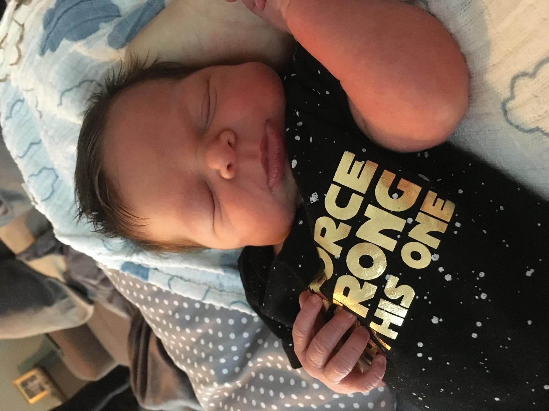 Greta als Baby – sie hat das Williams-Beuren-Syndrom Greta als Baby – sie hat das Williams-Beuren-Syndrom