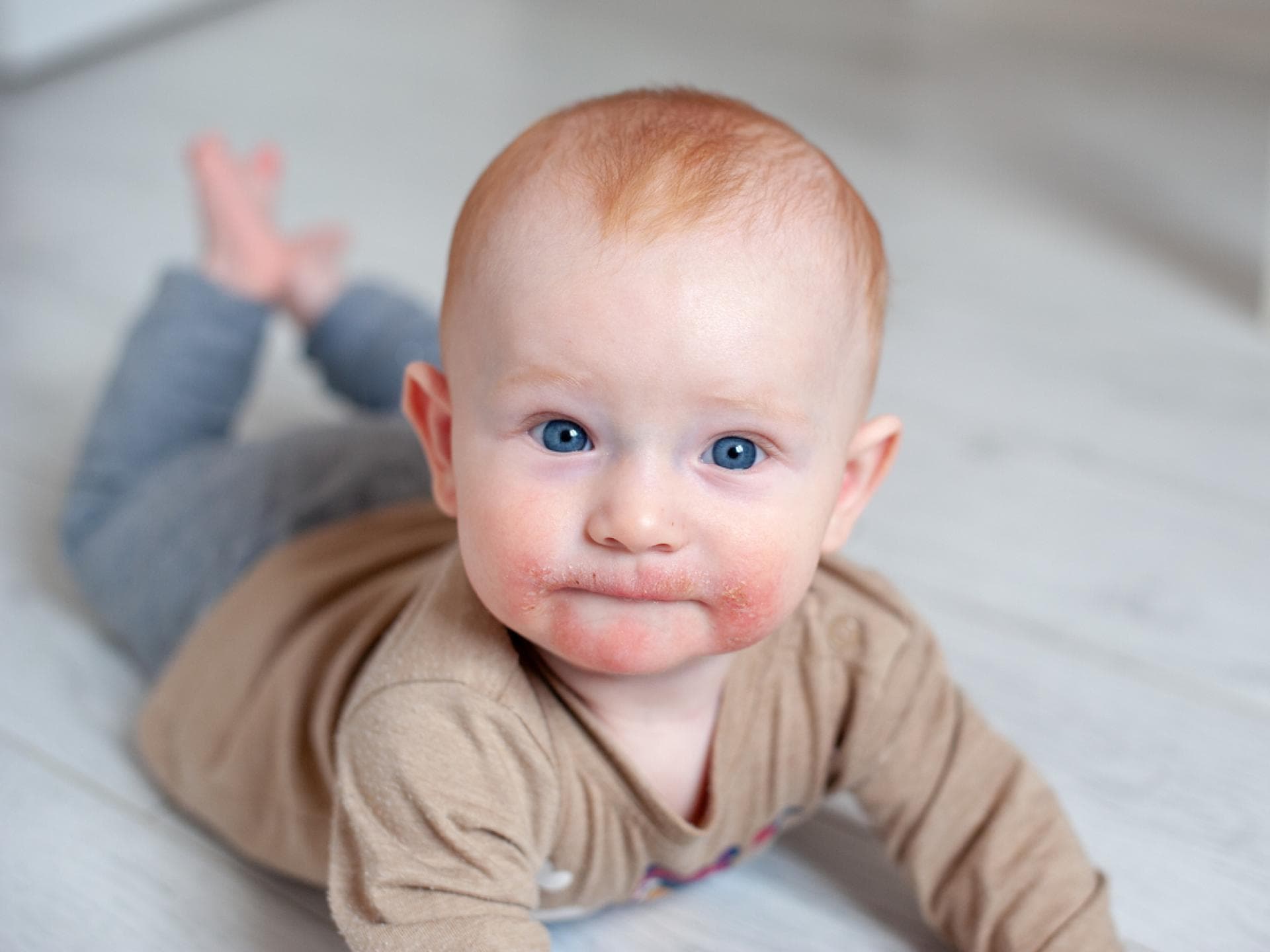Baby hat Ausschlag vom Zahnen