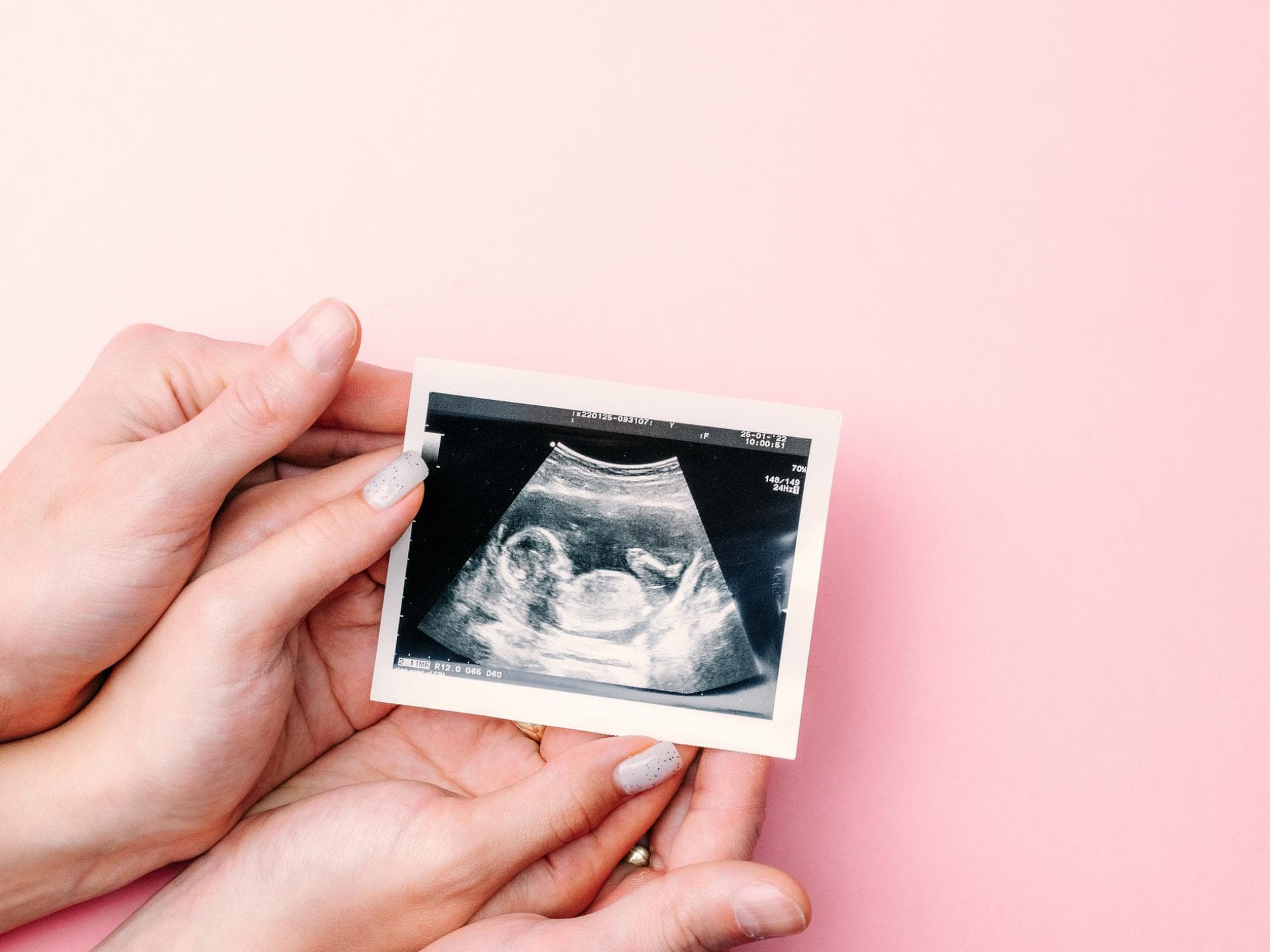 Frauenhände, die Ultraschallbild auf rosa Hintergrund halten.