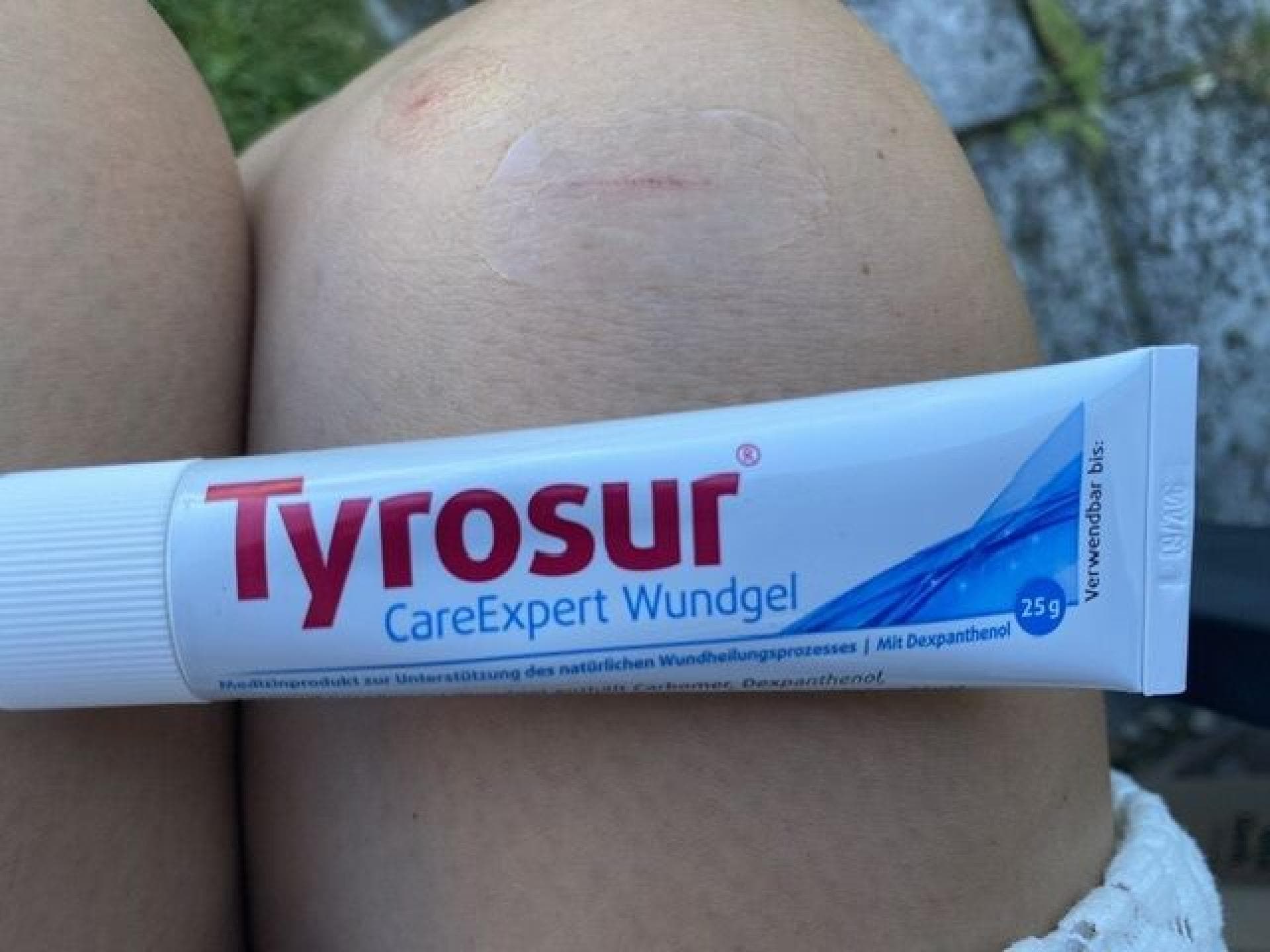 Das Wundgel von Tyrosur ist ideal für kleine Verletzungen und leichte Verbrennungen. Das Wundgel von Tyrosur ist ideal für kleine Verletzungen und leichte Verbrennungen.