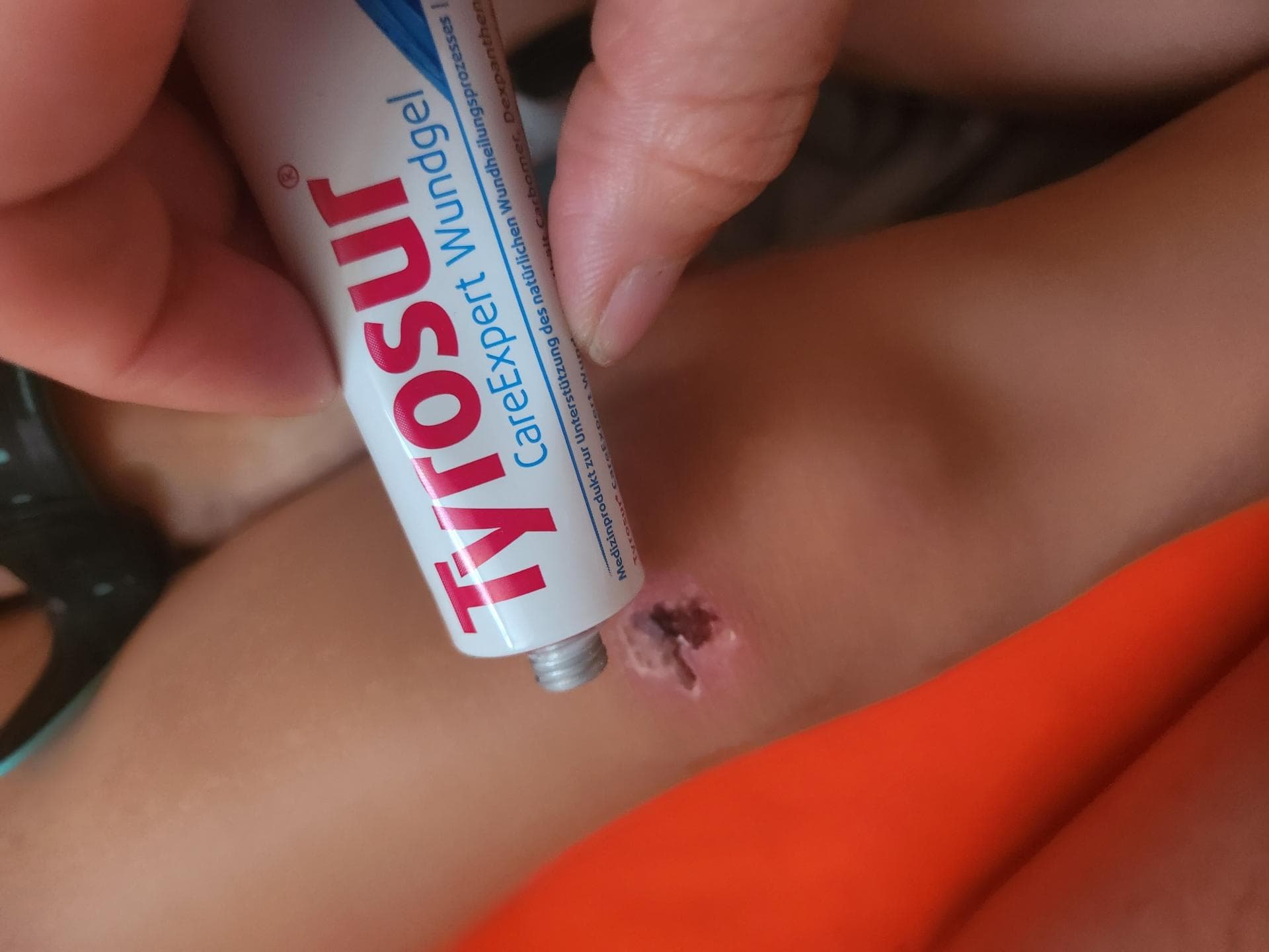 Das "CareExpert Wundgel" sollte in keiner Hausapotheke fehlen. Das "CareExpert Wundgel" sollte in keiner Hausapotheke fehlen.