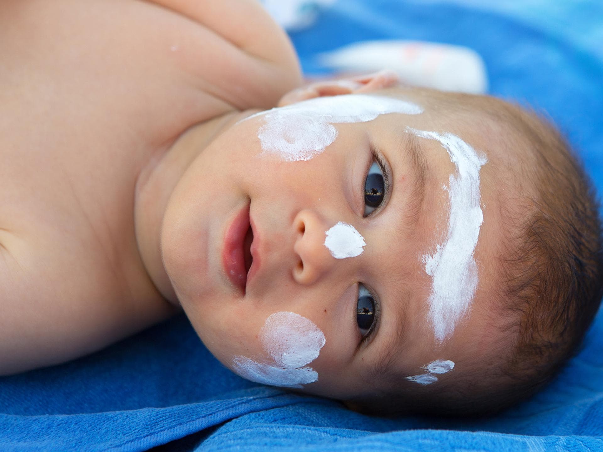 Babys und Kleinkinder sind besonders anfällig für Hitzepickel. Je heller der Hauttyp desto eher. 