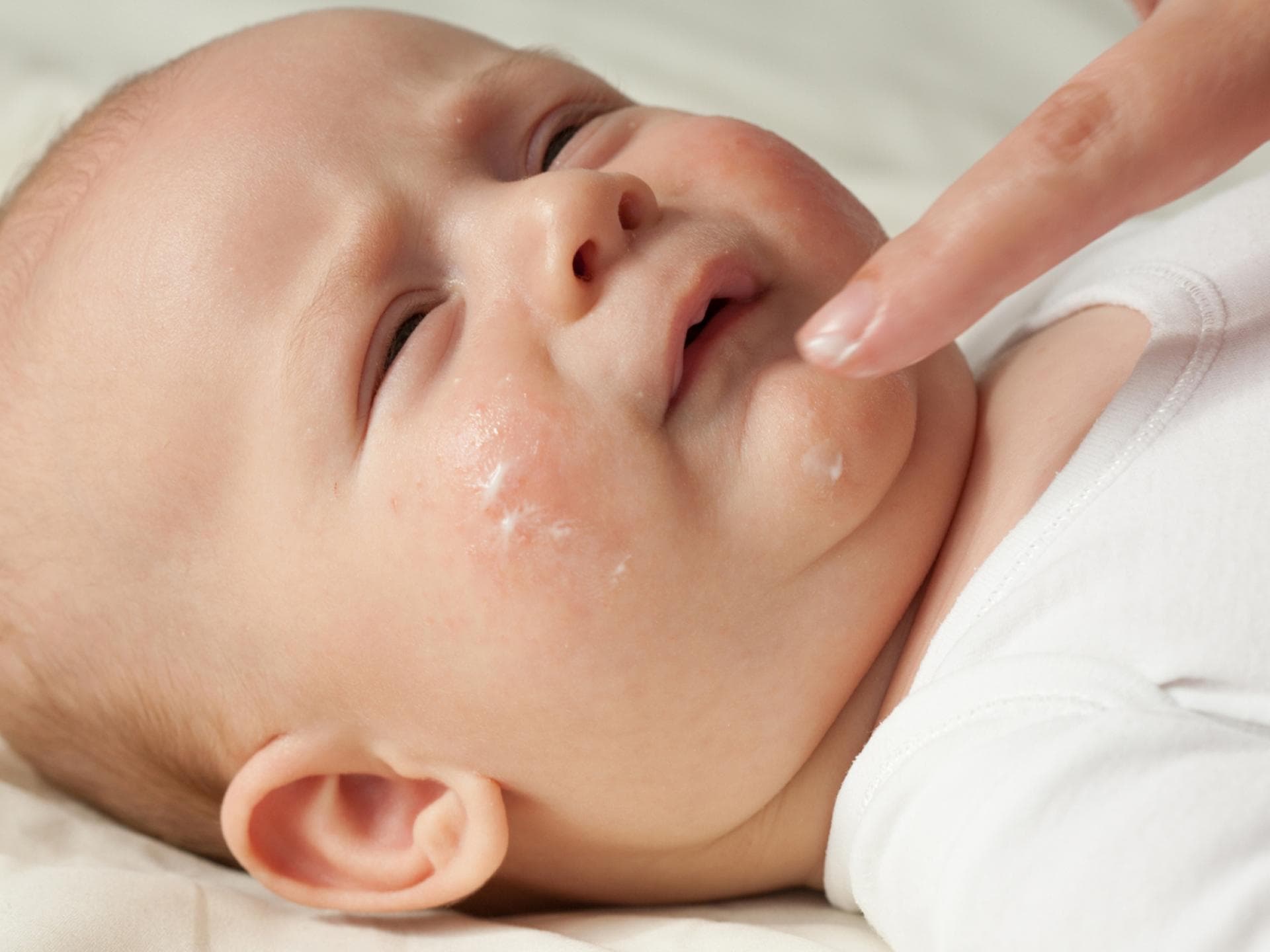 Baby bekommt das Gesicht eingecremt.